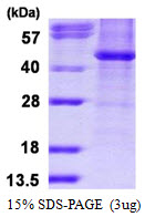 protq9by41 sdspage human histone deacetylase 8 recombinant protein