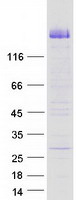 Coomassie blue staining of purified CDHR2 protein