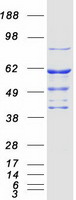 Coomassie blue staining of purified STK33 protein