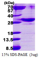 3ug by SDS-PAGE under reducing condition and visualized by coomassie blue stain
