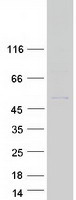 protq9bzg8 ovca1 dph1 human recombinant protein