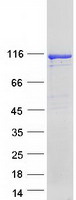 protq9bzl6 protein kinase d2 prkd2 human recombinant protein