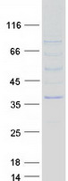 protq9bzq4 nmnat2 human recombinant protein