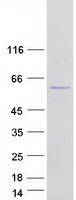 Coomassie blue staining of purified UBXN6 protein