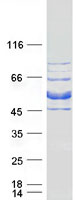 Coomassie blue staining of purified CIPC protein