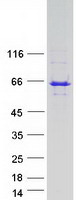 protq9c0e8 lnp lnpk human recombinant protein