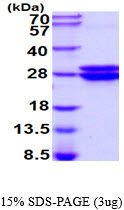 protq9cpu0 sdspage mouse glyoxalase i recombinant protein