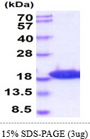 protq9cqv6 sdspage mouse map1lc3b recombinant protein