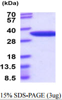 3ug by SDS-PAGE under reducing condition and visualized by coomassie blue stain