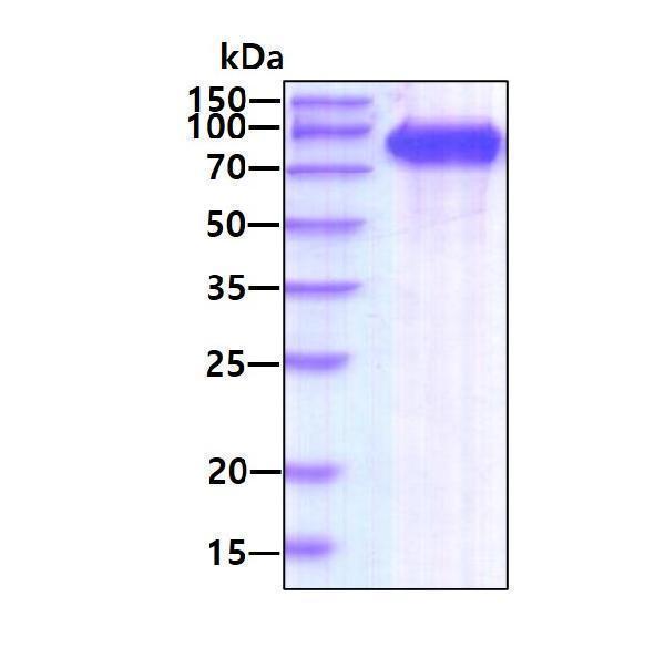 3ug by SDS-PAGE under reducing condition and visualized by coomassie blue stain