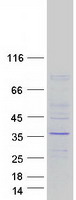 Coomassie blue staining of purified WDR61 protein
