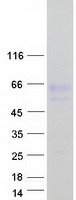 Coomassie blue staining of purified NYX protein