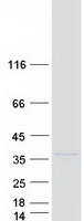 protq9gzu7 ctdsp1 human recombinant protein
