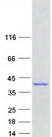 Coomassie blue staining of purified ANKRD2 protein