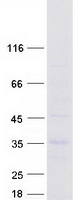 protq9gzy6 ntal lat2 human recombinant protein