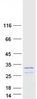 protq9h081 mis12 human recombinant protein