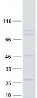Coomassie blue staining of purified USP44 protein