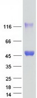 protq9h0f6 sharpin human recombinant protein