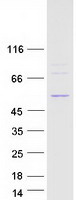 protq9h0s4 ddx47 human recombinant protein