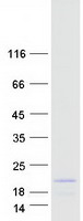 Coomassie blue staining of purified RBM38 protein