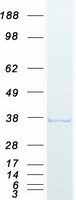 protq9h147 dnttip1 human recombinant protein
