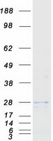 Coomassie blue staining of purified STMN4 protein