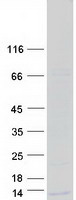 protq9h1f0 wfdc10a human recombinant protein