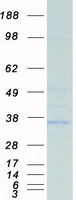 Coomassie blue staining of purified ATG5 protein