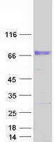Coomassie blue staining of purified CDH23 protein
