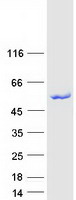 Coomassie blue staining of purified TRIT1 protein
