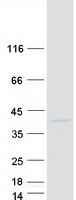 Coomassie blue staining of purified TCEAL2 protein