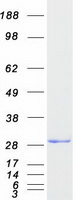 Coomassie blue staining of purified CENPH protein