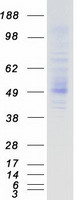 protq9h3s3 tmprss5 human recombinant protein
