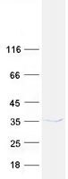 Coomassie blue staining of purified CUEDC2 protein