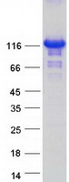 Coomassie blue staining of purified ZHX3 protein