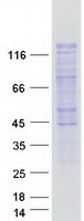protq9h4l7 smarcad1 human recombinant protein