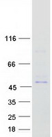 protq9h6s1 azi2 human recombinant protein