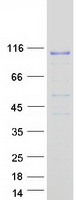 Coomassie blue staining of purified BCAS3 protein