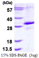 3ug by SDS-PAGE under reducing condition and visualized by coomassie blue stain.