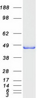 Coomassie blue staining of purified ELAC1 protein