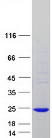 Coomassie blue staining of purified IFT22 protein