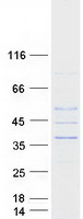 Coomassie blue staining of purified AKTIP protein