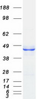 Coomassie blue staining of purified QTRT2 protein