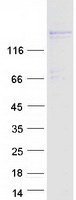 Coomassie blue staining of purified PRDM16 protein