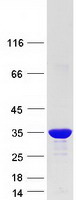 Coomassie blue staining of purified CACYBP protein