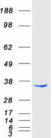 Coomassie blue staining of purified RDH14 protein