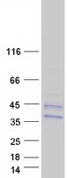 Coomassie blue staining of purified CLTRN protein
