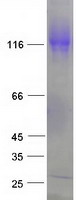 Coomassie blue staining of purified EML4 protein