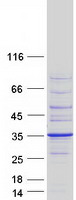 protq9hcu9 brms1 human recombinant protein