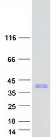 protq9hd15 sra1 human recombinant protein